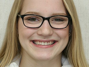 Girl with aligned teeth