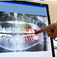 Person pointing at X-Ray