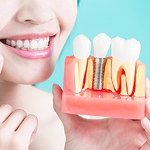 a person holding a model of dental implants in Montgomery