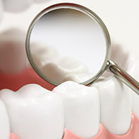 Dental mirror placed on smile after dental sealants