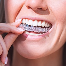 Closeup of patient placing clear aligners on top teeth