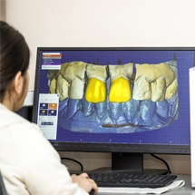 Dentist using iTero intraoral scanner images for dental treatment plan