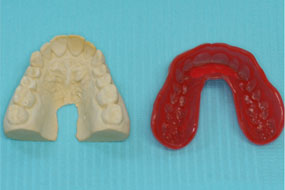 Proform mouthguard and model teeth side by side