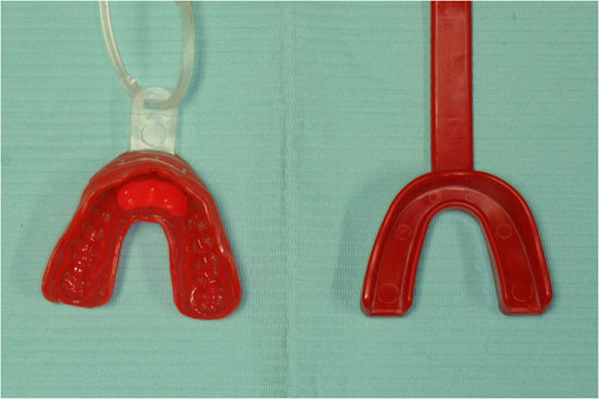 Proform mouthguard and tray side by side