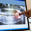 Person pointing at x-ray on monitor