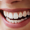 Person with flawless teeth smiling