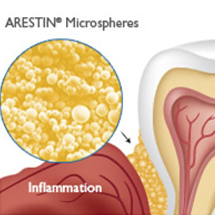 Diagram of ARESTIN and teeth
