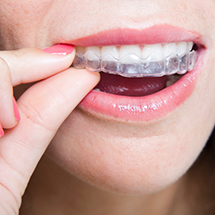 Patient placing Invisalign clear braces tray