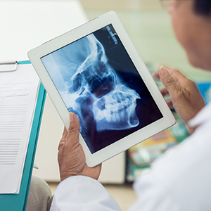 Dentist holding tablet showing x-ray used in T M J therapy plan