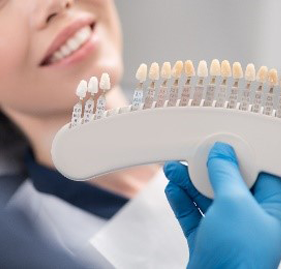 Patient's smile compared with porcelain veneer shade chart